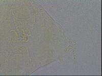 Echiniscus trisetosus image