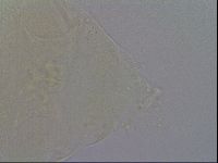 Echiniscus trisetosus image