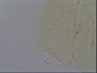 Echiniscus trisetosus image