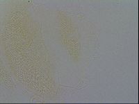Echiniscus trisetosus image