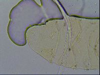 Echiniscus trisetosus image