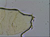 Echiniscus trisetosus image