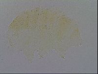 Echiniscus trisetosus image