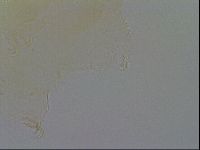Echiniscus trisetosus image