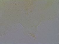 Echiniscus trisetosus image