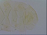 Echiniscus trisetosus image