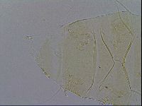 Echiniscus trisetosus image