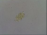 Echiniscus trisetosus image