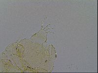 Echiniscus trisetosus image