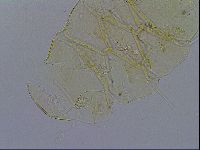 Echiniscus trisetosus image