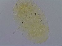 Echiniscus trisetosus image