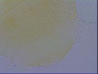 Echiniscus trisetosus image