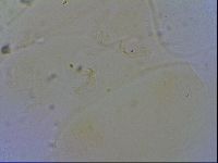 Echiniscus trisetosus image