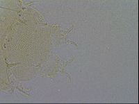 Echiniscus trisetosus image