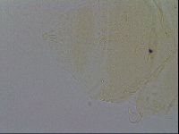 Echiniscus trisetosus image