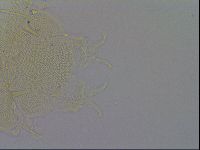 Echiniscus trisetosus image