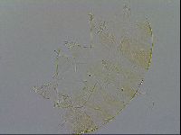 Echiniscus trisetosus image