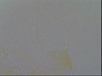 Echiniscus trisetosus image