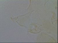 Echiniscus trisetosus image