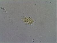 Echiniscus trisetosus image