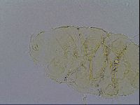 Echiniscus trisetosus image
