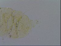 Echiniscus trisetosus image