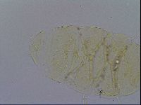 Echiniscus trisetosus image