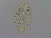 Echiniscus trisetosus image