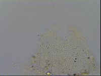 Echiniscus trisetosus image
