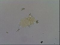 Echiniscus trisetosus image