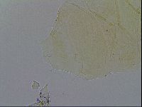 Echiniscus trisetosus image