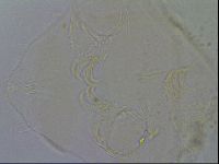 Media resource of Echiniscus trisetosus