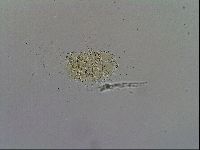 Echiniscus trisetosus image