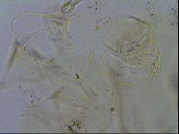Echiniscus trisetosus image
