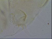 Echiniscus trisetosus image