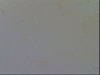 Echiniscus trisetosus image