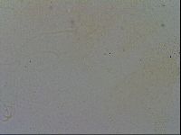 Echiniscus trisetosus image