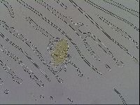 Echiniscus trisetosus image