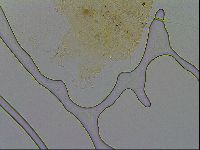 Echiniscus trisetosus image