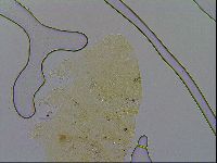 Echiniscus trisetosus image