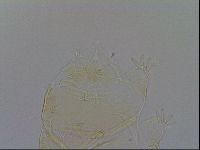 Echiniscus trisetosus image