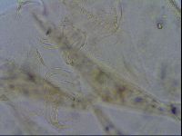 Echiniscus trisetosus image