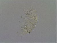 Echiniscus trisetosus image