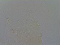 Echiniscus trisetosus image