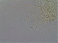 Echiniscus trisetosus image