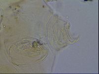 Echiniscus blumi image
