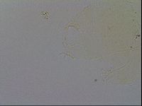 Echiniscus trisetosus image