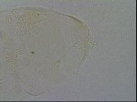 Echiniscus trisetosus image