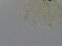 Echiniscus trisetosus image