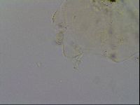 Echiniscus trisetosus image